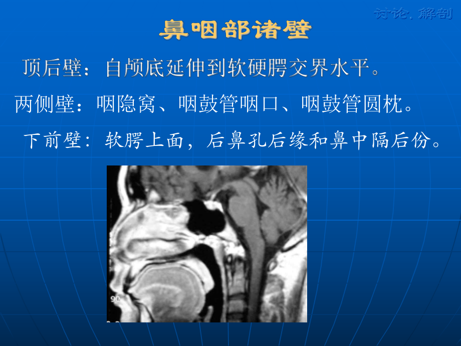 医学精品课件：鼻咽癌CT与MR诊断.ppt_第3页