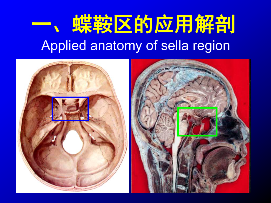 医学精品课件：蝶鞍区断层解剖与影像对照.ppt_第1页