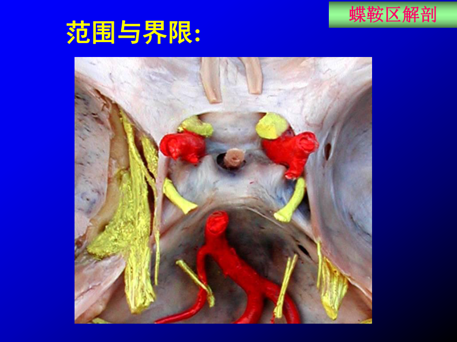 医学精品课件：蝶鞍区断层解剖与影像对照.ppt_第2页