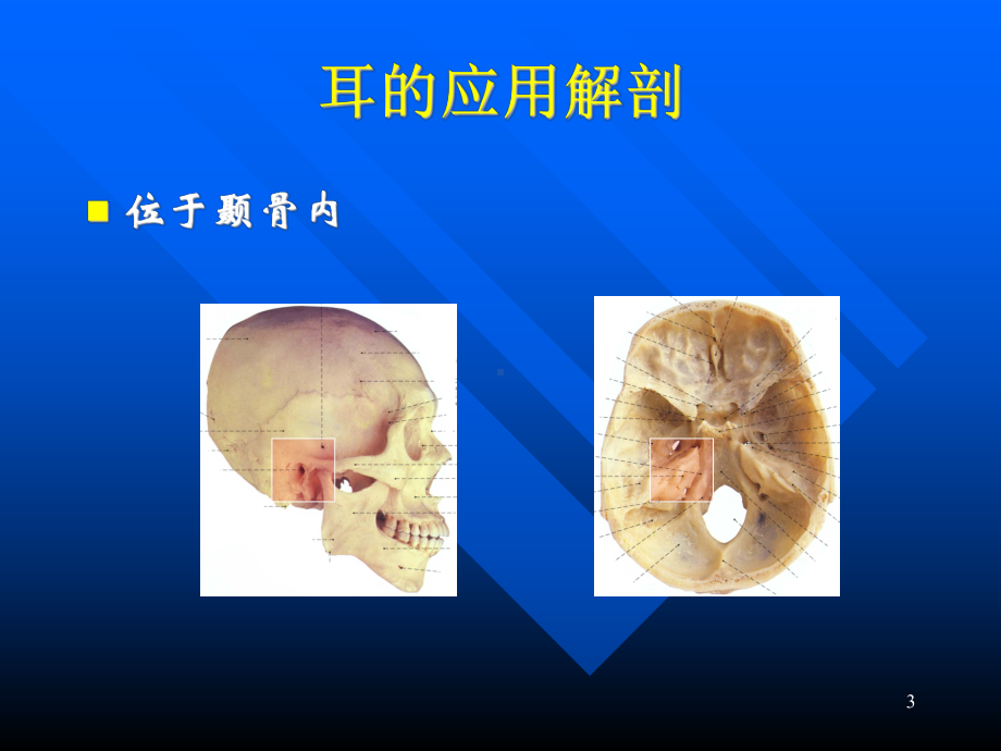 医学精品课件：耳应用解剖耳生理.ppt_第3页