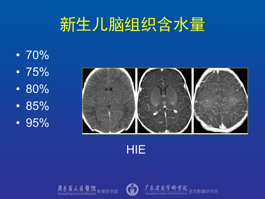 医学精品课件：儿童神经系统影像诊断.ppt_第3页