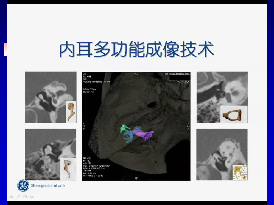 医学精品课件：耳部影像诊断(精).ppt_第2页