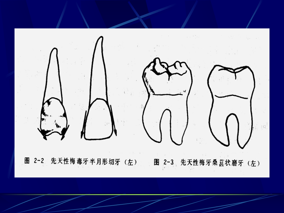 医学精品课件：全身病在口腔的表现.ppt_第3页