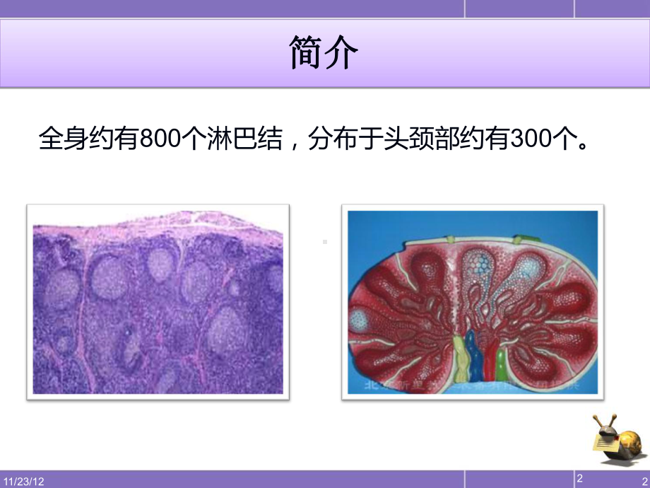 医学精品课件：颈部淋巴结病变影像表现.ppt_第2页