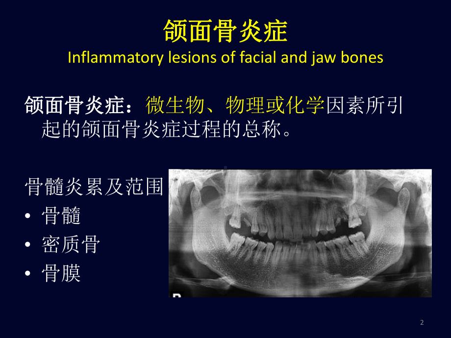 医学精品课件：颌面骨炎症.ppt_第2页