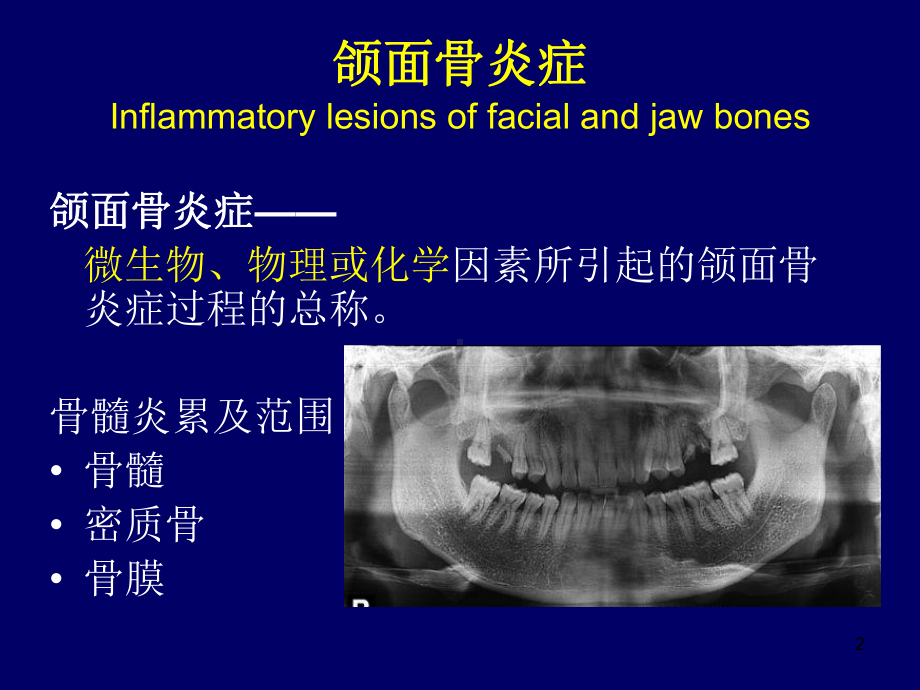 医学精品课件：口腔影诊颌骨炎症大课-李坚.ppt_第2页