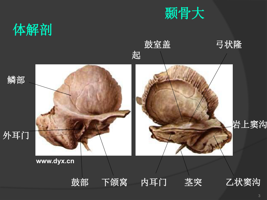 医学精品课件：颞骨断层解剖及CT三维重建.ppt_第3页