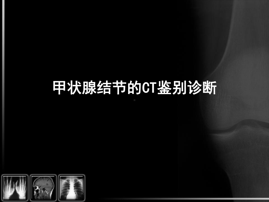 医学精品课件：甲状腺结节的CT鉴别诊断.ppt_第1页