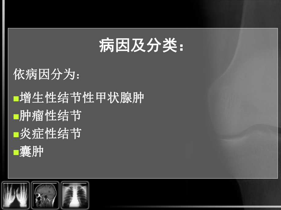 医学精品课件：甲状腺结节的CT鉴别诊断.ppt_第2页