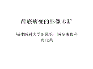 医学精品课件：颅底病变的影像诊断.ppt