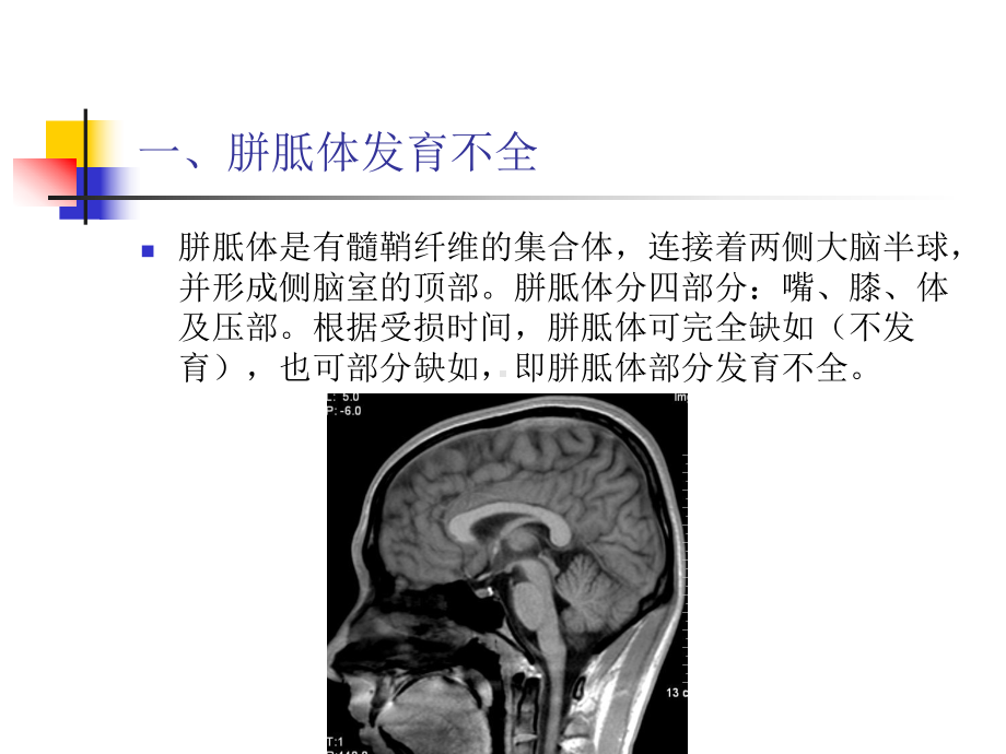 医学精品课件：颅脑先天畸形影像诊断.ppt_第3页