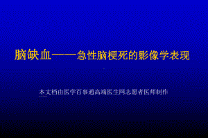 医学精品课件：脑缺血—急性脑梗死的影像学表现.ppt