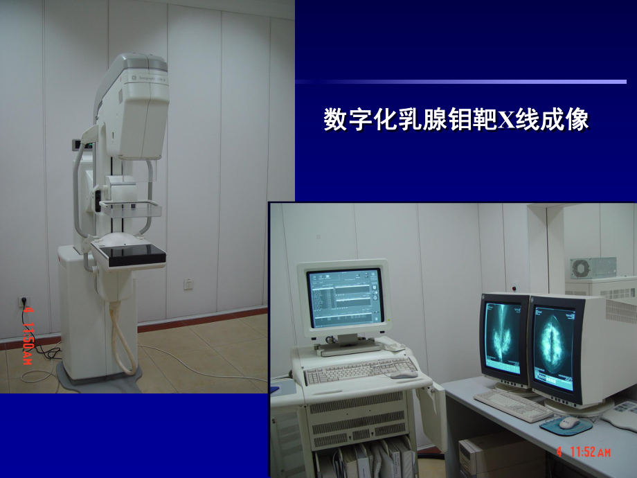 医学精品课件：面肌痉挛与三叉神经痛MR诊断.ppt_第3页