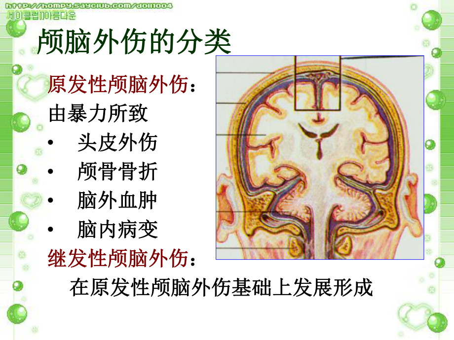 医学精品课件：颅脑外伤的影像诊断.ppt_第2页