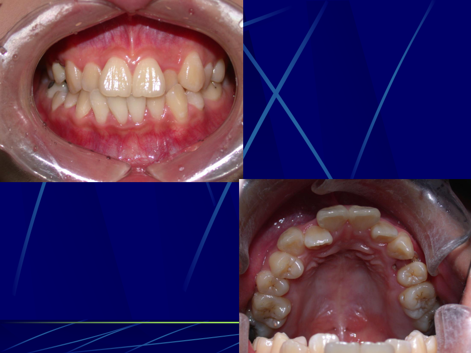 医学精品课件：口腔正畸修复.ppt_第3页