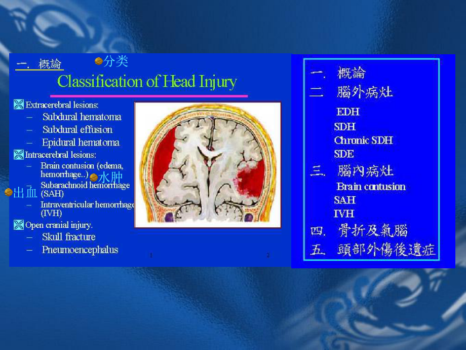 医学精品课件：颅脑外伤幻灯及脑肿瘤.ppt_第3页