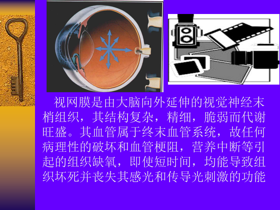 医学精品课件：视网膜病2（liufurong）-5.ppt_第3页