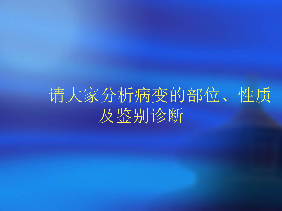 医学精品课件：髓母细胞瘤读片 (2).ppt_第3页