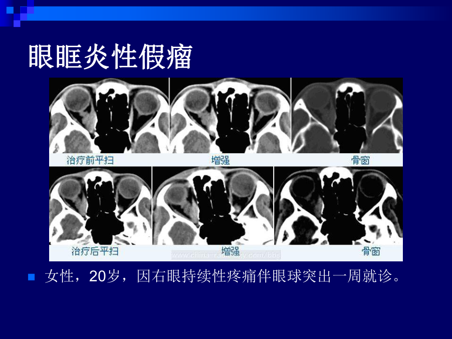 医学精品课件：五官和颈部典型病例读片.ppt_第2页