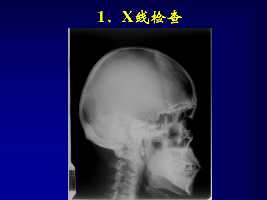 医学精品课件：中枢神经系统放射诊断.ppt_第3页