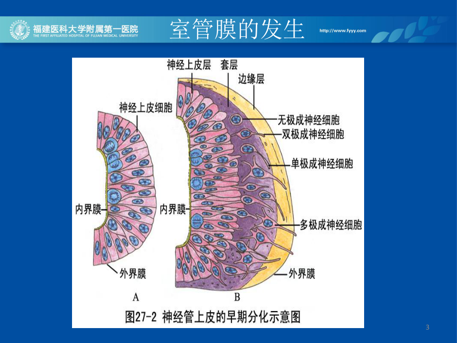 医学精品课件：室管膜和脉络膜肿瘤鉴别诊断.ppt_第3页