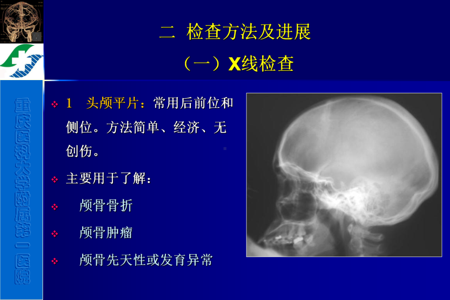 医学精品课件：神经系统影像诊断1.ppt_第3页