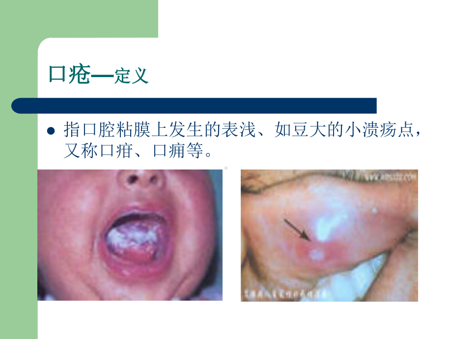 医学精品课件：中医药适宜技术课件.ppt_第3页