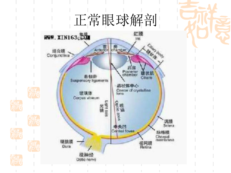 医学精品课件：眼球病变影像诊断与鉴别诊断.ppt_第3页