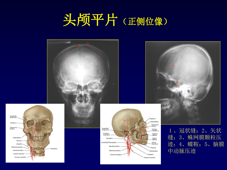 医学精品课件：中枢神经系统影像学 (2).ppt_第3页