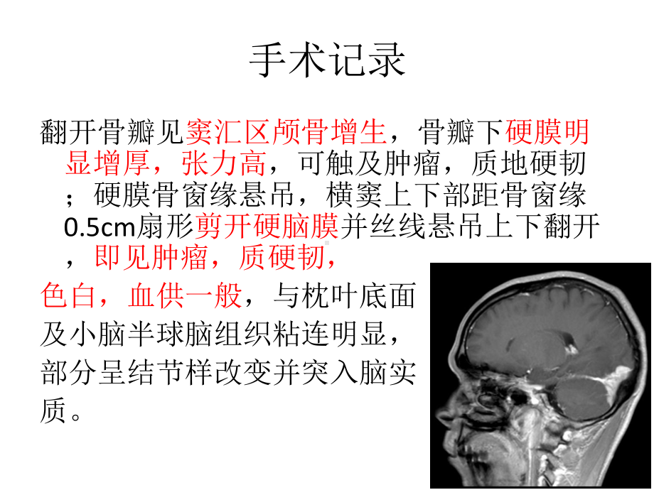 医学精品课件：中枢神经系统的RDD诊断.ppt_第2页