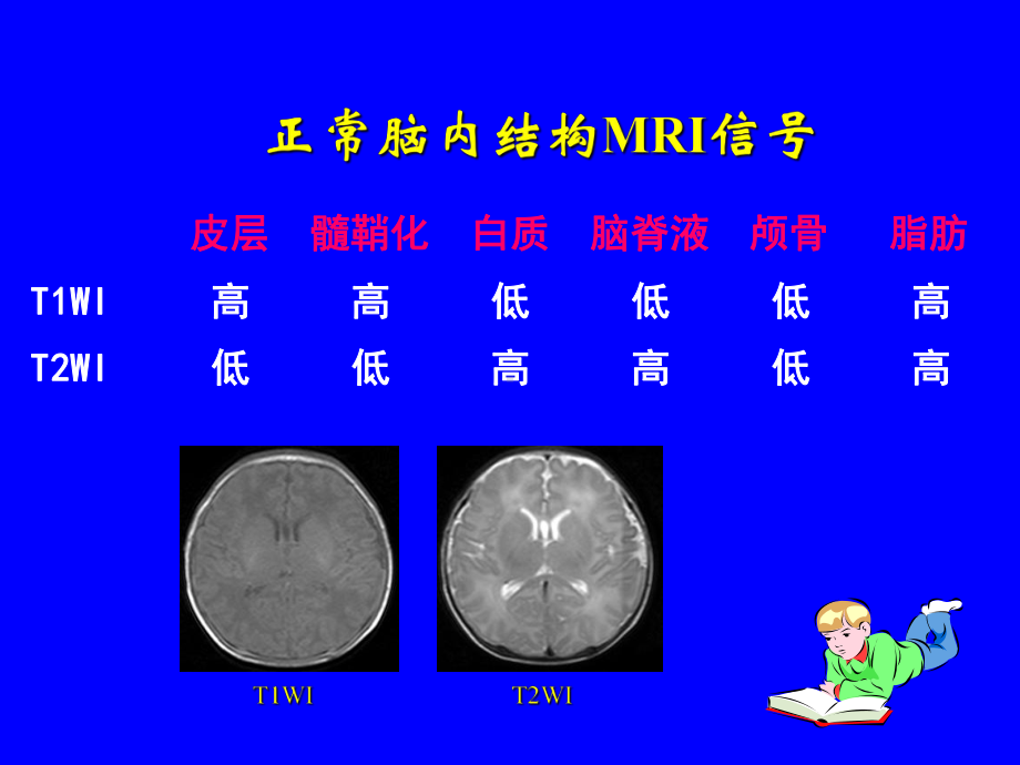 医学精品课件：新生儿头部磁共振成像.ppt_第3页