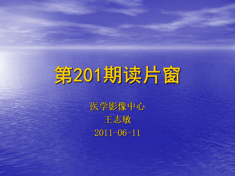 医学精品课件：右侧顶枕叶间变型节细胞胶质细胞瘤.ppt_第1页