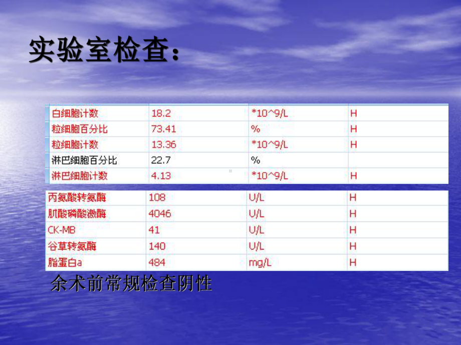 医学精品课件：右侧顶枕叶间变型节细胞胶质细胞瘤.ppt_第3页