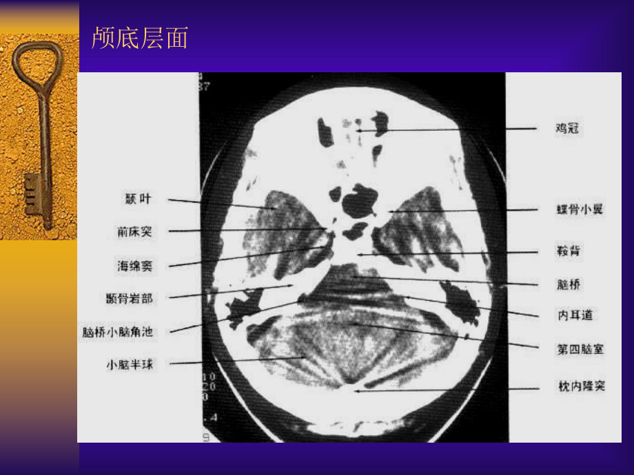 医学精品课件：中枢神经系统及头颈部.ppt_第3页