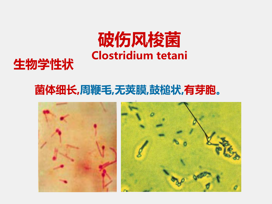 《医学免疫学》课件13第26章 厌氧性细菌.ppt_第3页