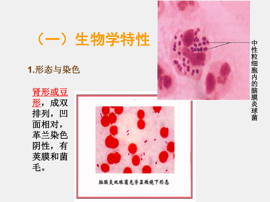 《病原生物学与免疫学》课件10章1节二、脑膜炎奈瑟菌.ppt_第3页