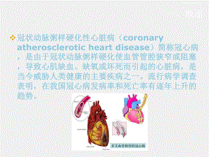 《康复医学》课件第五章 第十四节 冠心病的康复.ppt