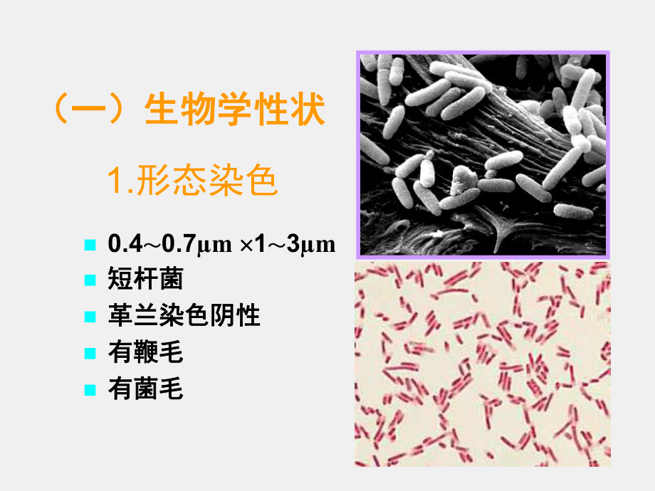 《病原生物学与免疫学》课件10章2节一、埃希菌属.ppt_第3页