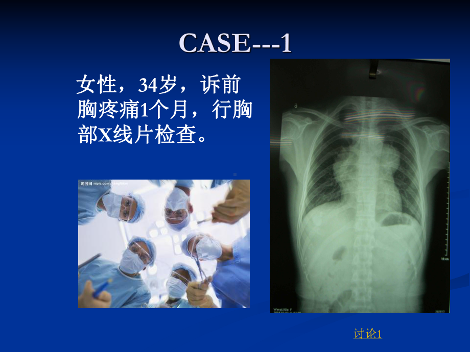 医学精品课件：肿瘤学纵隔肿瘤.ppt_第2页