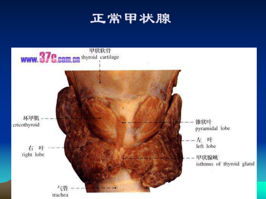 医学精品课件：甲状腺疾病.ppt_第2页