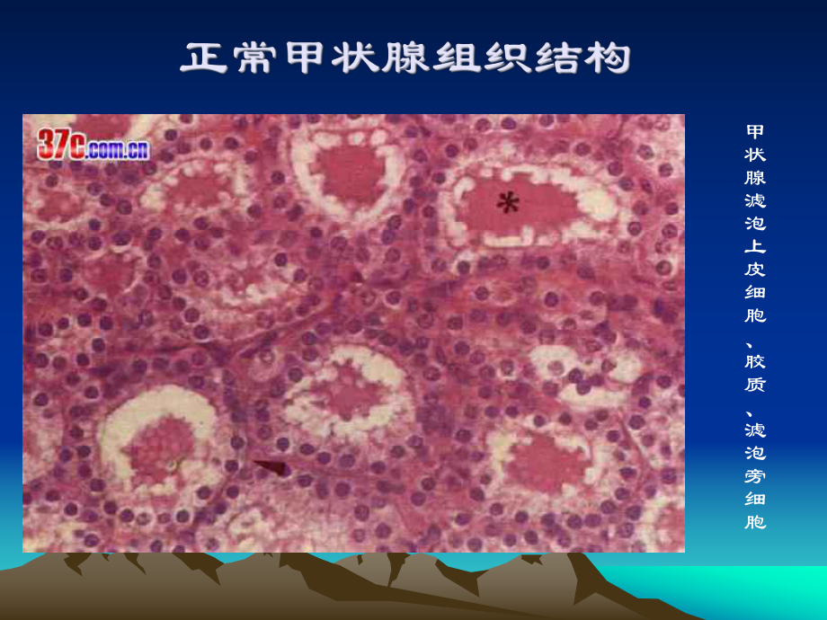 医学精品课件：甲状腺疾病.ppt_第3页