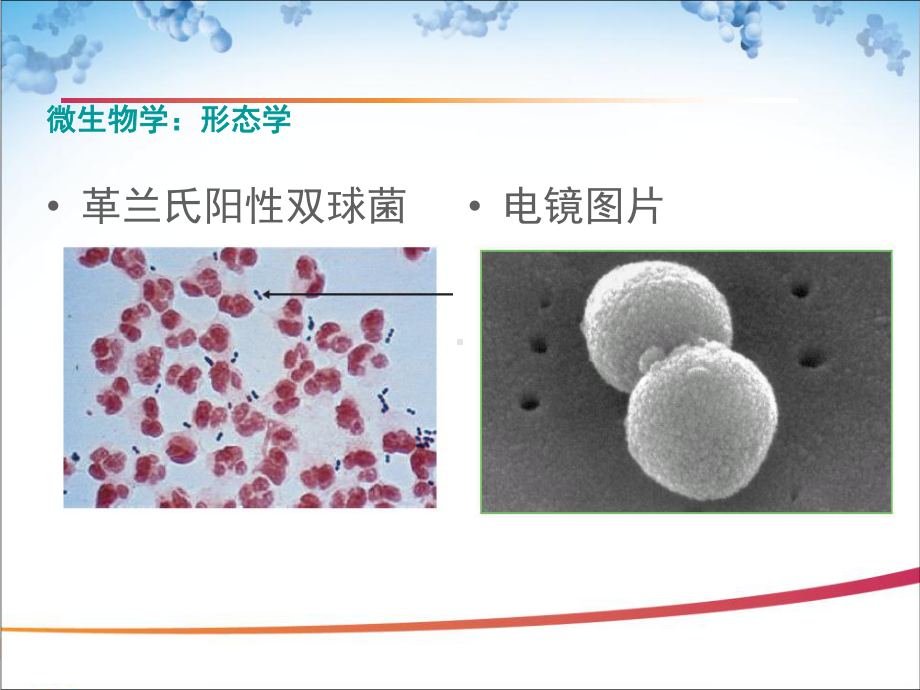 医学精品课件：刘晖儿童肺炎链球菌感染.ppt_第3页