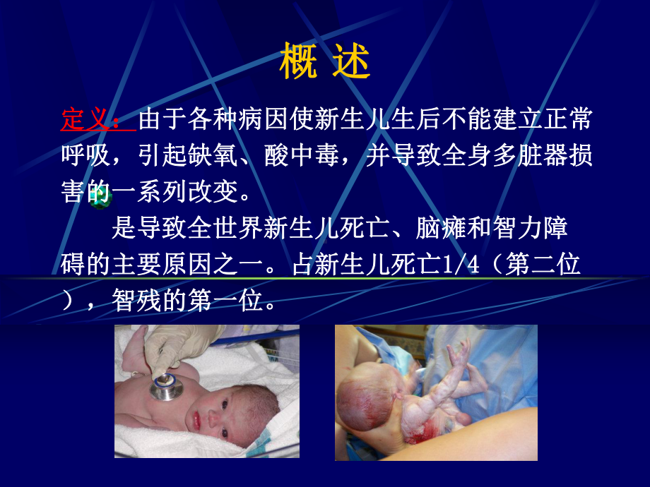 医学精品课件：新生儿窒息-HIE-ICH.ppt_第2页