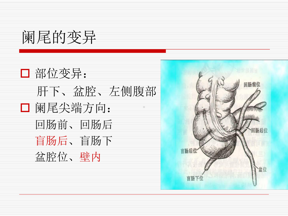 医学精品课件：2阑尾炎.ppt_第3页