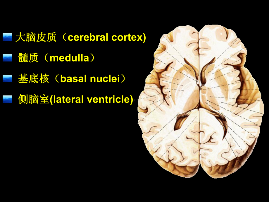 医学精品课件：端脑.ppt_第3页