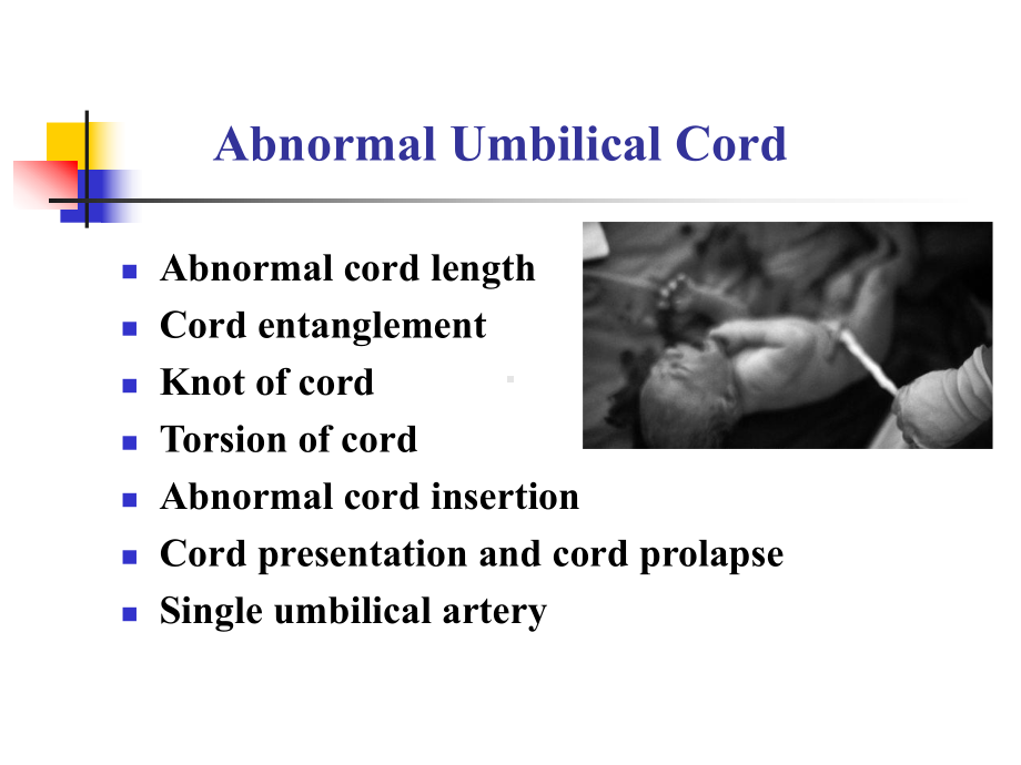医学精品课件：3脐带异常等.ppt_第2页