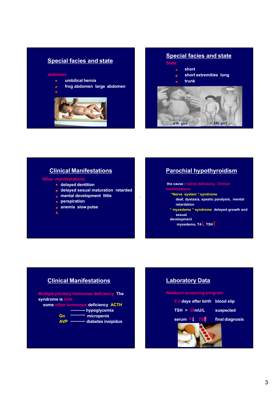 医学精品课件：先天性甲减.pptx_第3页