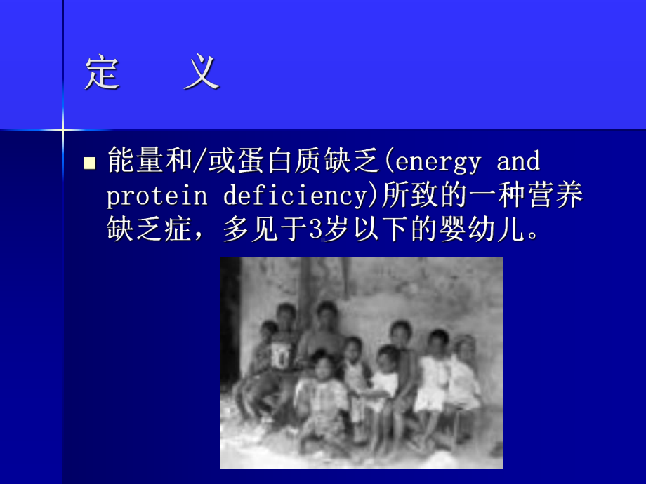 医学精品课件：1营养不良.ppt_第2页