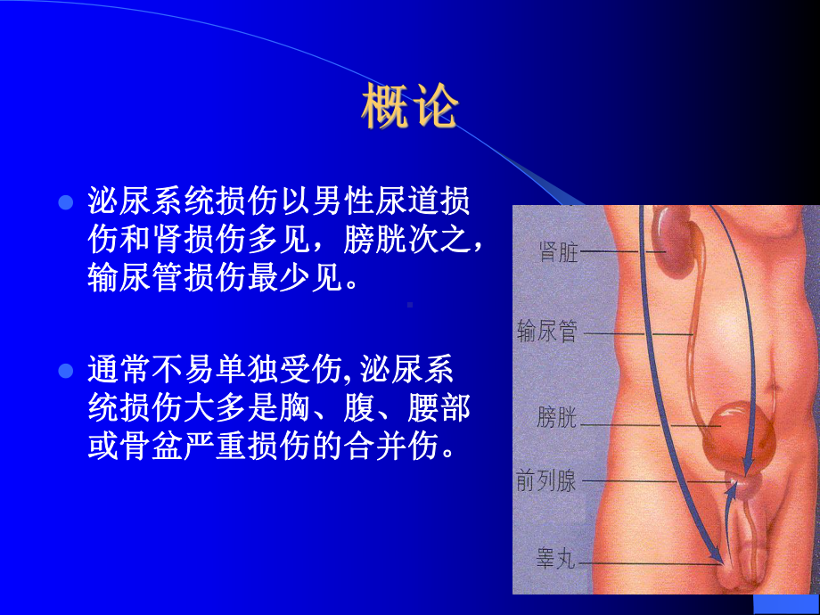 医学精品课件：13泌尿系损伤·结石.ppt_第3页