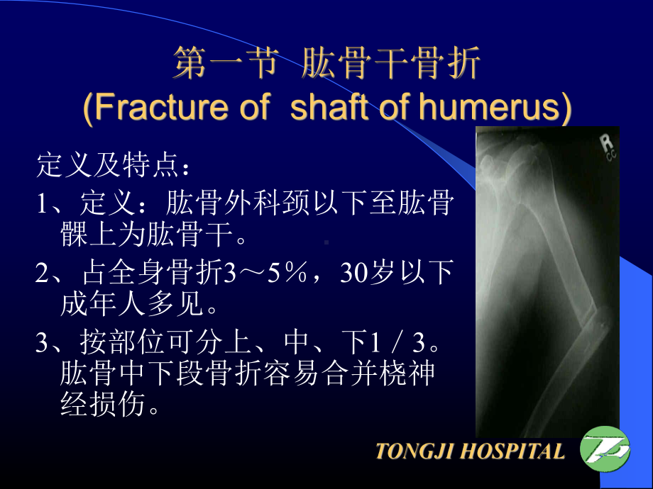 医学精品课件：上肢骨折、关节损伤.ppt_第3页